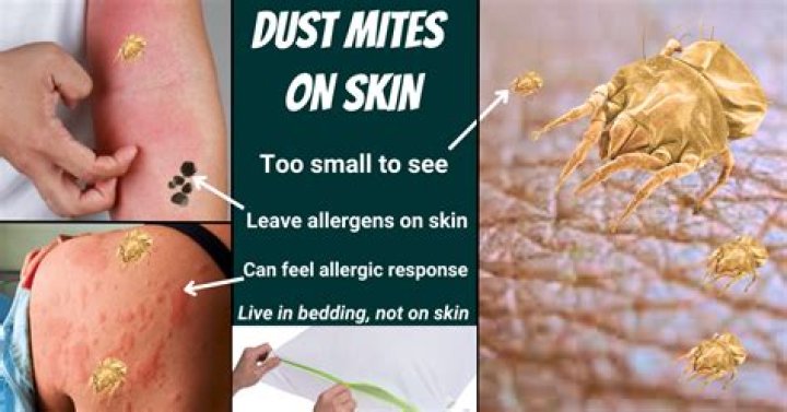 Can you feel dust mites crawling on your skin?