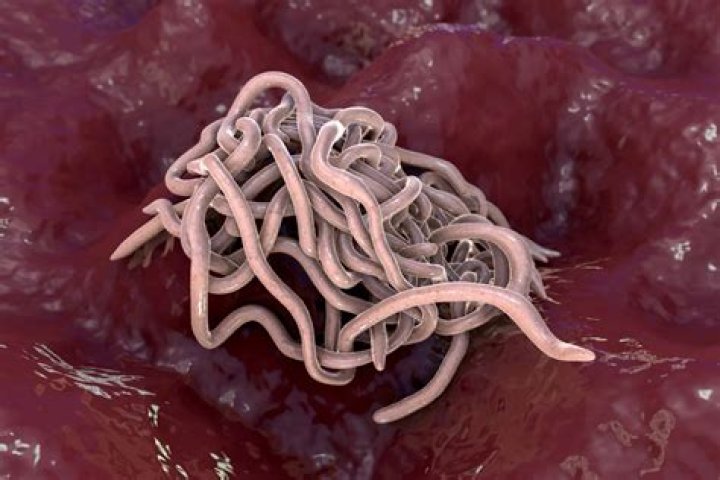 Can you get worms from Bologna?