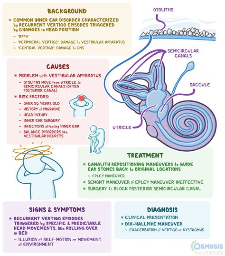 How do I know if my dizziness is from anxiety?