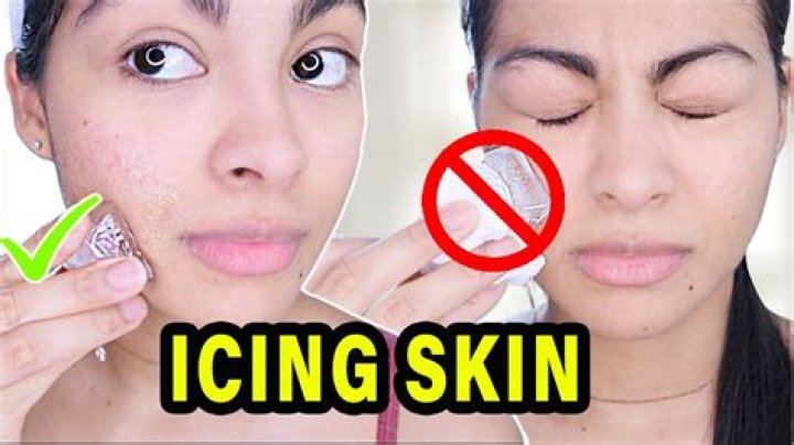 Should I rub ice on my face?